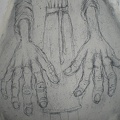 Why Do My Hands Hurt So Much? - Detail