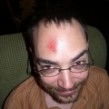 Head Wound