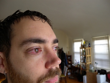 Morning after contacts